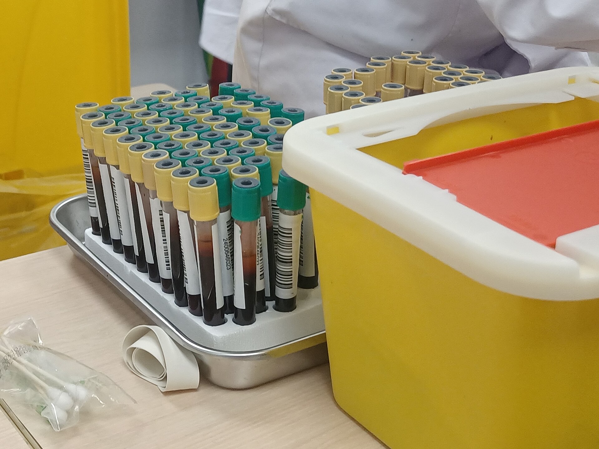 Rak berisi tabung sampel darah di ruang laboratorium